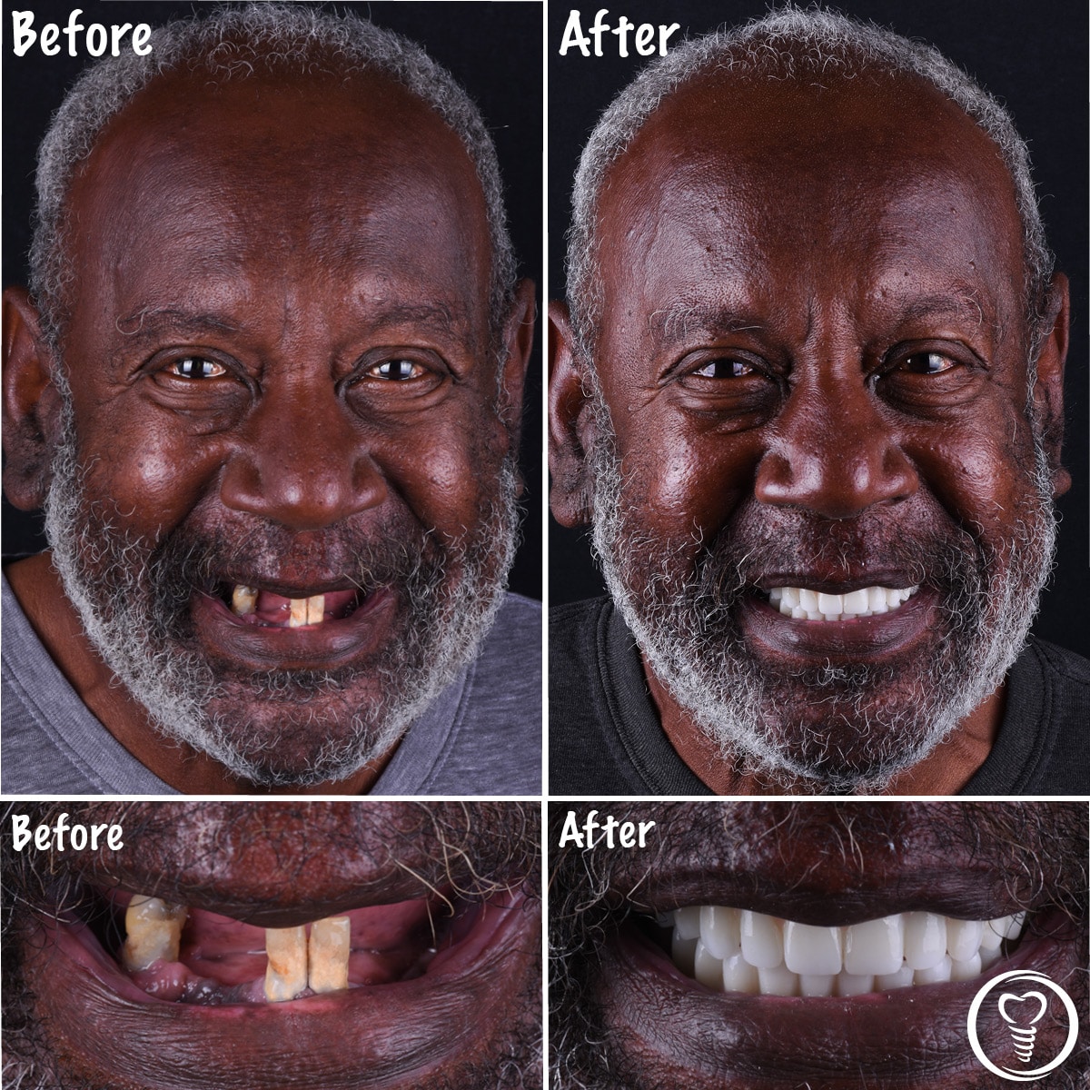 A mature guy knew the impact of having healthy teeth and gums.