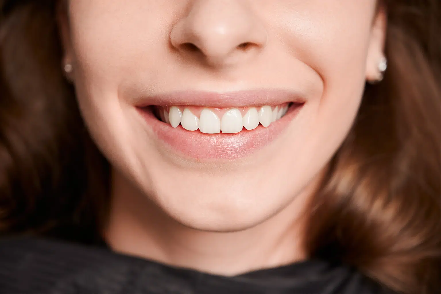 Teeth Whitening For Sensitive Teeth