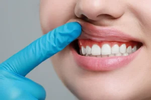 Hole In Gums - 4 Check-up Procedures To Book In Tampa
