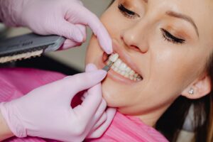 Understanding the Veneer Procedure at Spring Haven