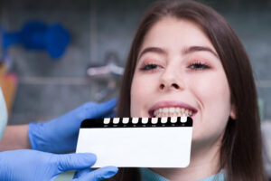 When and How to Replace Your Dental Veneers