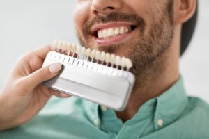 Essential Guide to Veneer Care and Maintenance